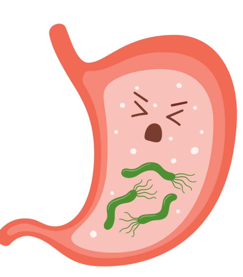 H Pylori: how to kill stomach bacteria and get&nbsp;happy